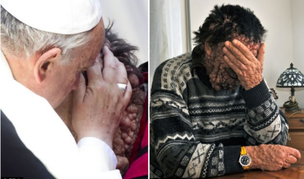 Vinicio Riva habla sobre su encuentro con el Papa: 'Yo sentía sólo amor'