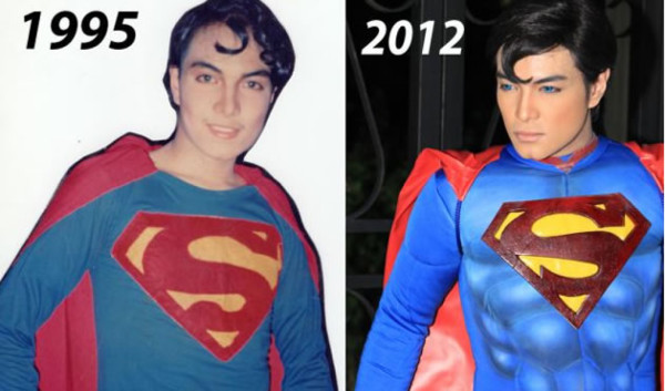 Se somete a 19 cirugías para parecerse a Superman