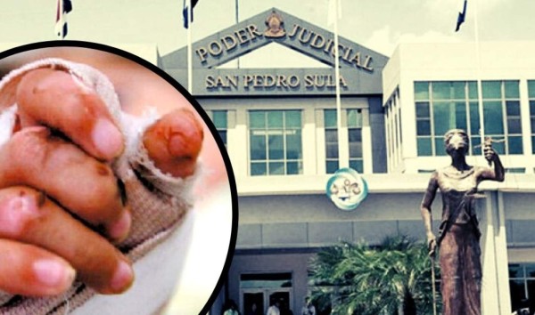 Padre habría quemado manos de su hija por negarse a grabar pornografía