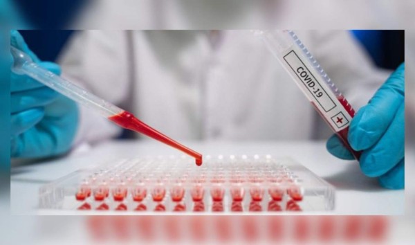 Honduras confirma presencia de la variante brasileña, británica y sudafricana del covid