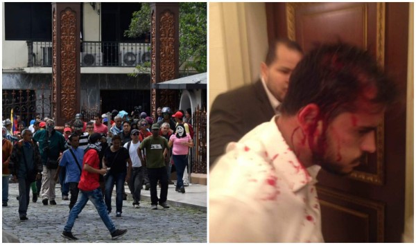 Chavistas irrumpen en Parlamento e hieren a diputado