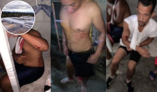 Al menos cinco muertos y más de 39 heridos tras reyerta en cárcel 'La Tolva'