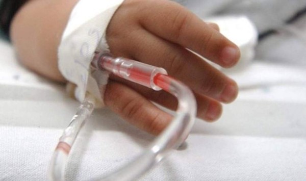 Niña de 2 años se quema el 80 % del cuerpo tras caerle chilate hirviendo  