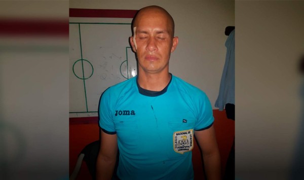 Árbitro Gerson Matute tras sufrir agresión: 'Son cosas que pueden pasar'