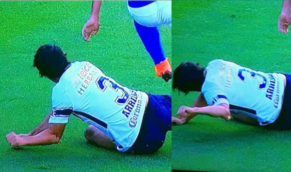 ¡Terrible! Futbolista español de Pumas sufre escalofriante lesión