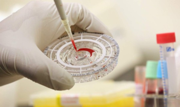 La FDA autoriza test de detección del ébola
