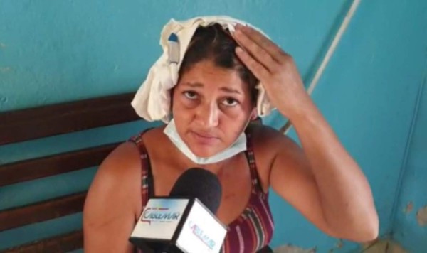 Mujer celosa ataca a su vecina con un machete en Copán