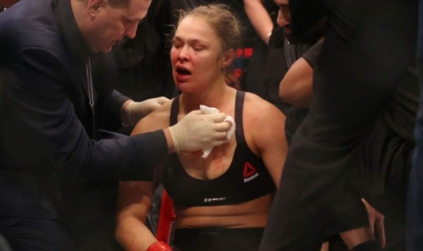Ronda Rousey estará dos meses de baja