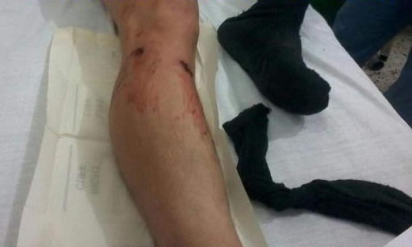 Hombres armados atacan patrulla militar en Trujillo