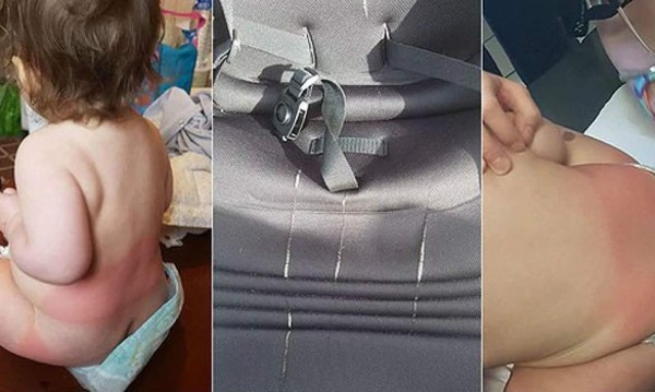 Lastiman con ácido a bebé de 14 meses