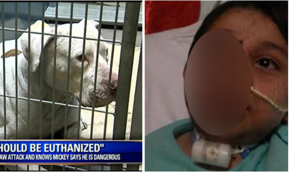 Donan más por salvar a pit bull que por reconstruir rostro a niño que mordió