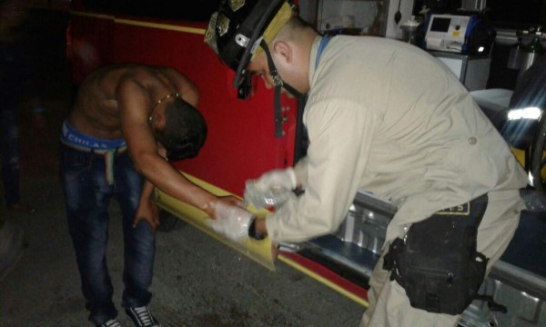 Cuatro menores quemados por pólvora en Nochebuena