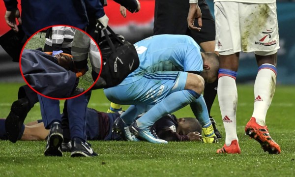 Mbappé es noqueado por portero del Lyon y deja la cancha en camilla