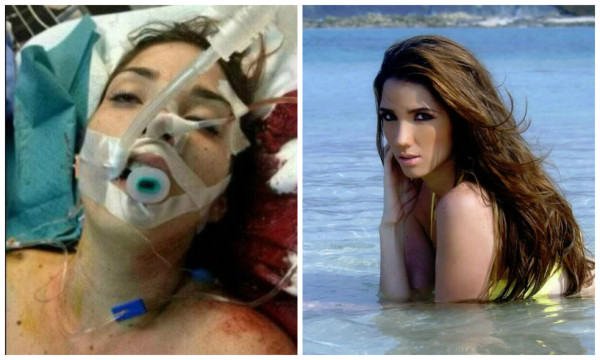 Murió Génesis Carmona, Miss de Venezuela herida en protestas