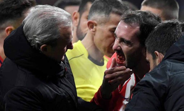 Defensor Diego Godín perdió un diente tras fuerte golpe