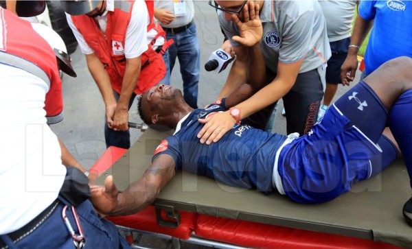 VIDEO: La escalofriante lesión que sufrió Rubilio Castillo