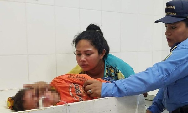 Tres niños se intoxican tras comer supuestas tajadas con veneno de ratas