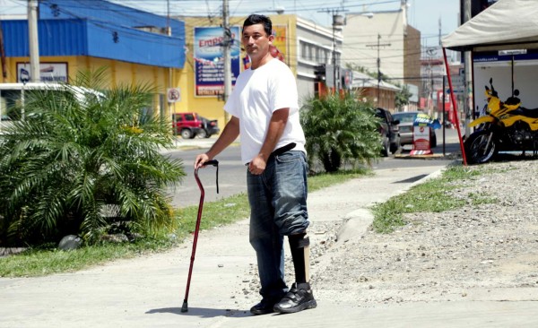 Tras 12 cirugías pide ayuda para terapias