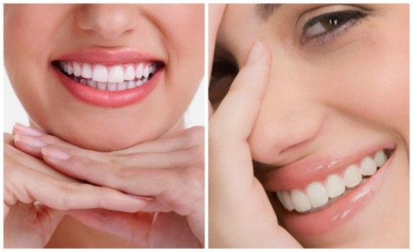 Las sonrisas más bonitas de las celebridades de Hollywood