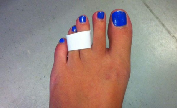 El esparadrapo, el mejor modo de proteger a los pies de las ampollas