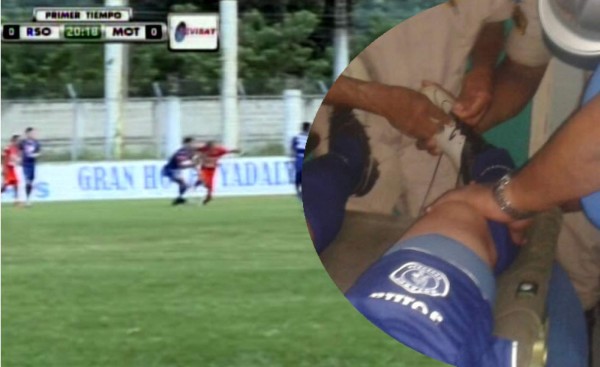 Video: La escalofriante lesión que sufrió Martín Pucheta del Motagua