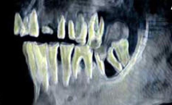 Identifican en Egipto a la momia de Hachepsut