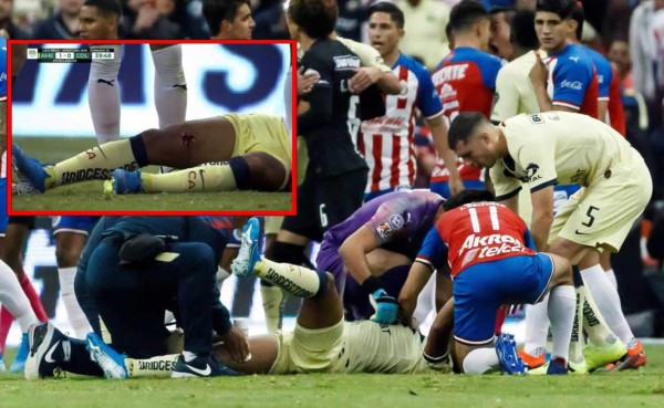 VIDEO: La escalofriante lesión que sufrió Giovani dos Santos en el América-Chivas
