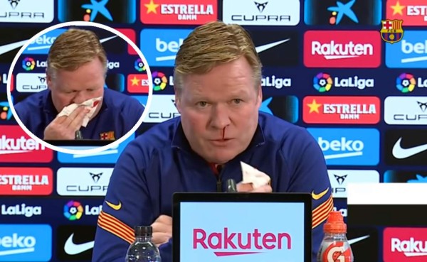 Ronald Koeman tuvo que interrumpir la conferencia de prensa por la hemorragia nasal.
