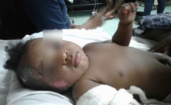 Niños mueren calcinados en incendio de vivienda en Colón