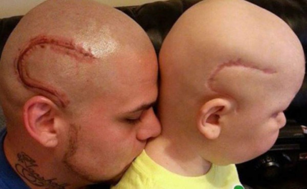 ¡Desgarrador!: La despedida del padre que se tatuó la cicatriz de su hijo