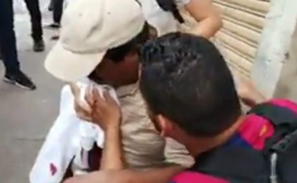 Video: albañil resulta herido de gravedad durante protestas en Honduras