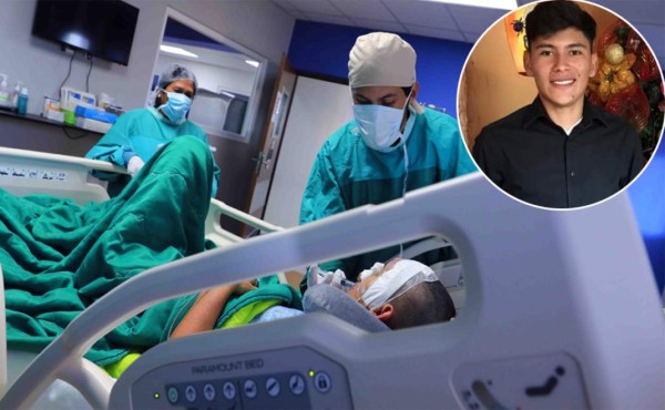 Hospital de Boston o un médico de India, las opciones para reconstruir rostro de Wilson