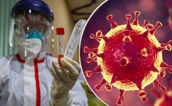 ¿De dónde son los 16 nuevos casos de coronavirus en Honduras?