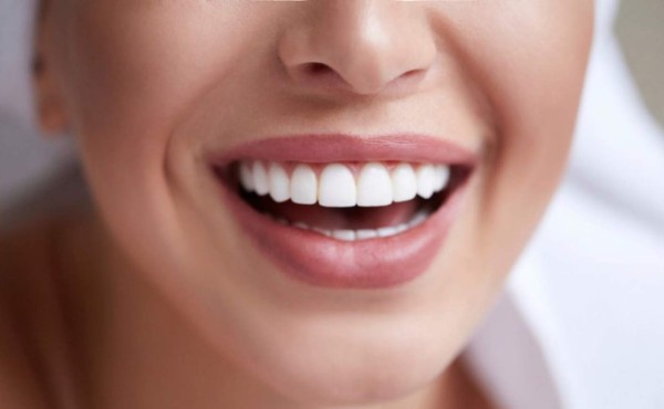 La blancorexia, un nuevo riesgo para la salud dental