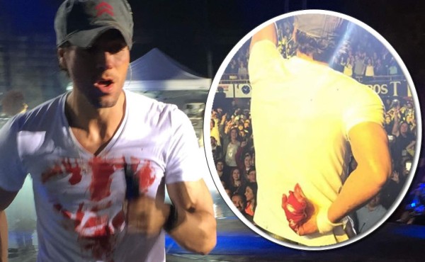 Enrique Iglesias será operado de la mano