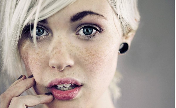 Las pecas...¿invaden tu cuerpo?