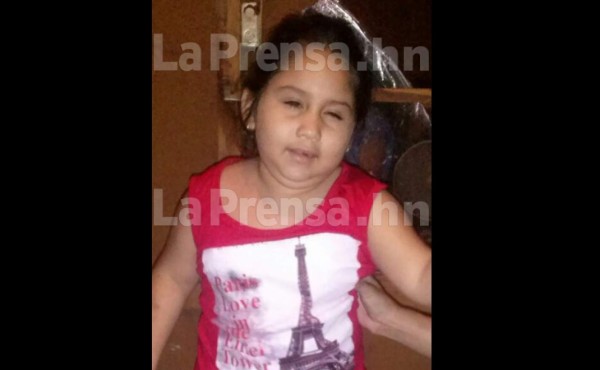 Muere niña hondureña que fue rescatada de incendio en Villanueva
