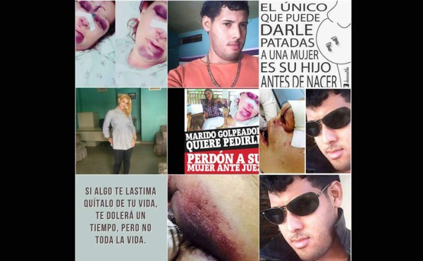 Caso de mujer agredida abre debate sobre violencia de género en Honduras   