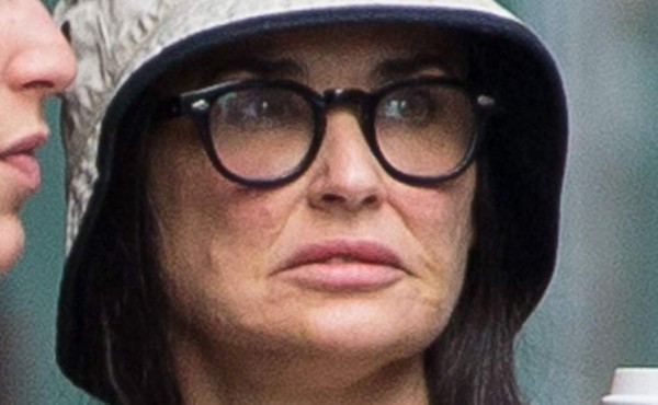 ¿Se le derritió el rostro a Demi Moore?