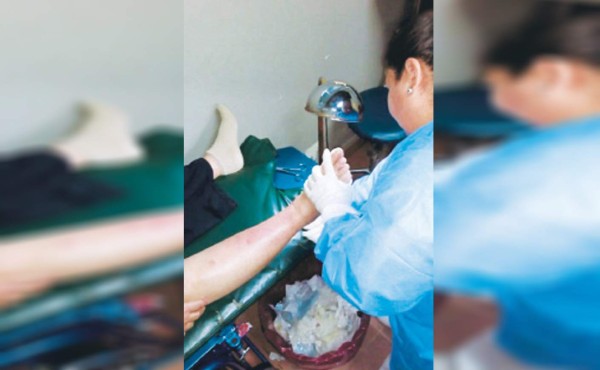 Más de 350 pacientes con pie diabético atienden en el IHSS