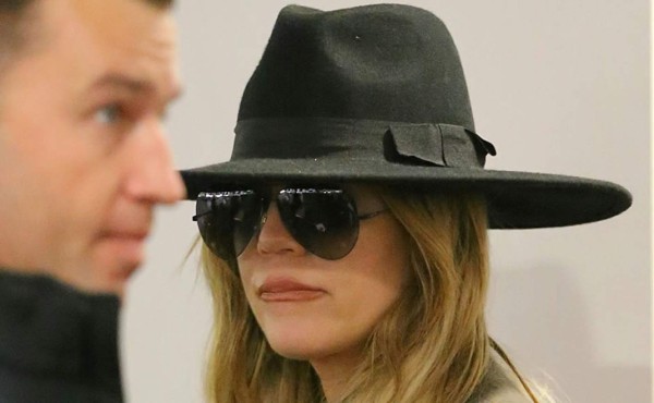 ¿Que se hizo en la cara Khloé Kardashian?