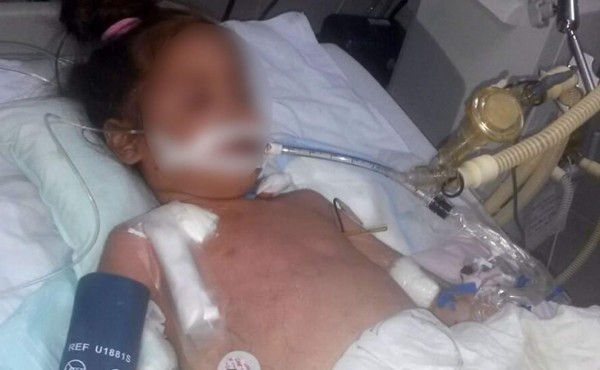 Urgen trasplantes para niños con cirrosis hepática