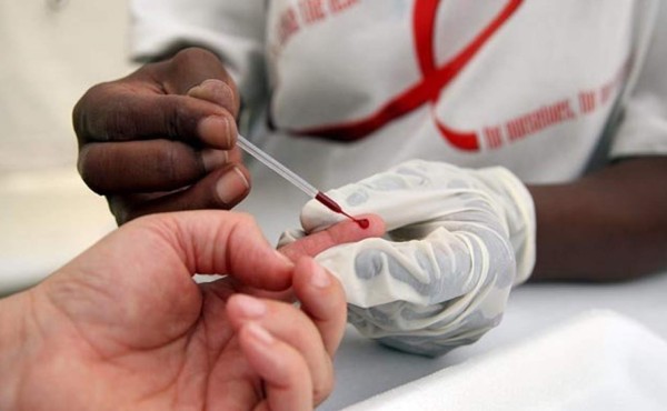 Científicos hallan nueva vacuna contra VIH efectiva en monos