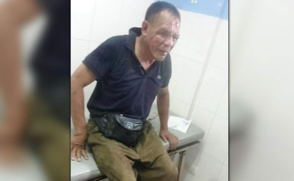 Rescatan a chapín que iban a matar en Chamelecón