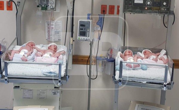 Hondureña da a luz a cuatrillizos tras inseminación artificial en San Pedro Sula