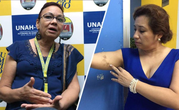 Directora de la Unah-vs: 'Jamás agredo a nadie”