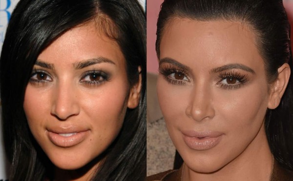 Los cambios del rostro de Kim Kardashian