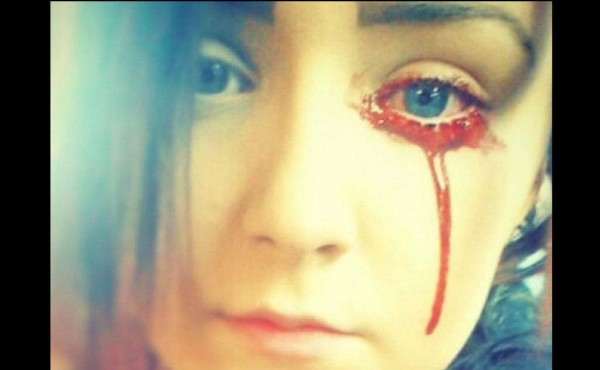 La joven que sangra por los ojos conmociona al Reino Unido