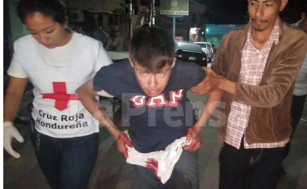 Hondureño se corta sus genitales en Copán