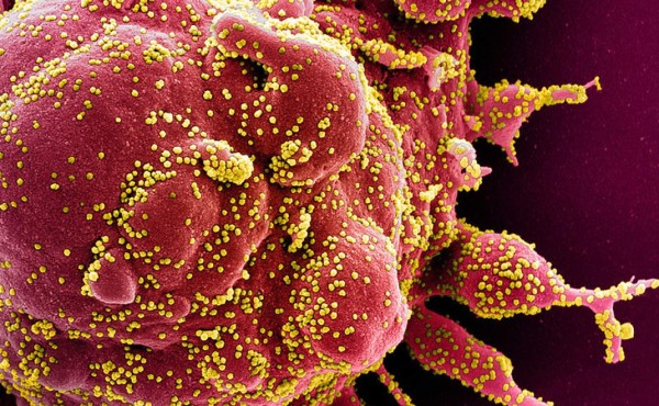 OMS: El coronavirus COVID-19 es de origen natural